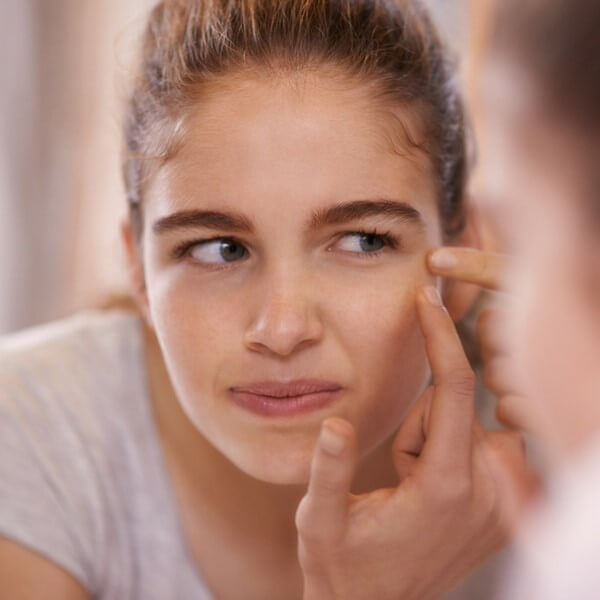 You CAN Get Rid Of Pimples Overnight: 10 Top Tips You Need